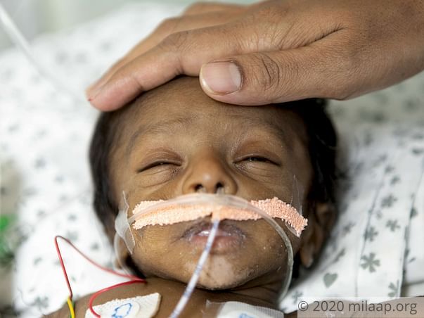1-Month-Old's Intestines Are Damaged Due To Milk Intolerance