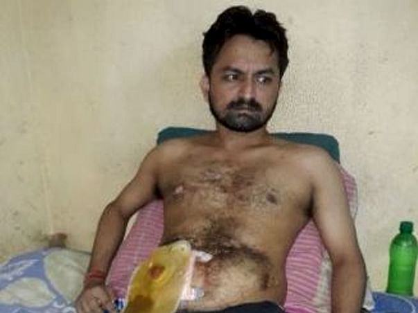 Help Pankaj Undergo His 8th Operation