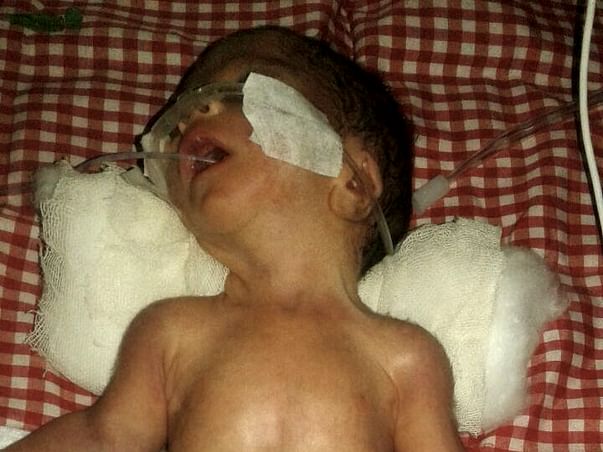 Help Ashok premature baby survive