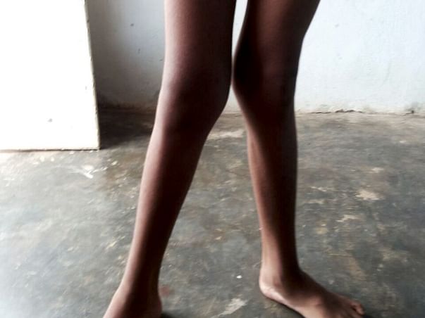 Help Nikhil Undergo Physiotherapy