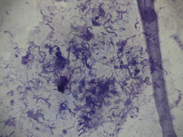 urine culture