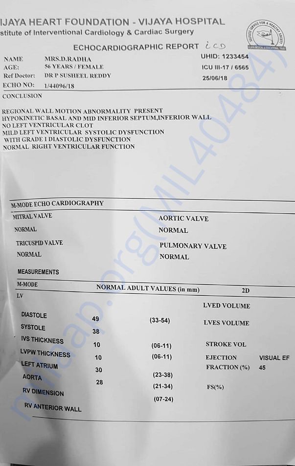ECHOCARDIOGRAPHIC ECG REPORT