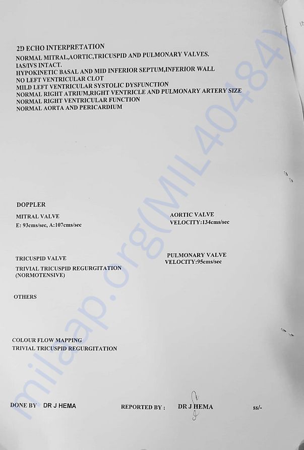 ECG REPORT