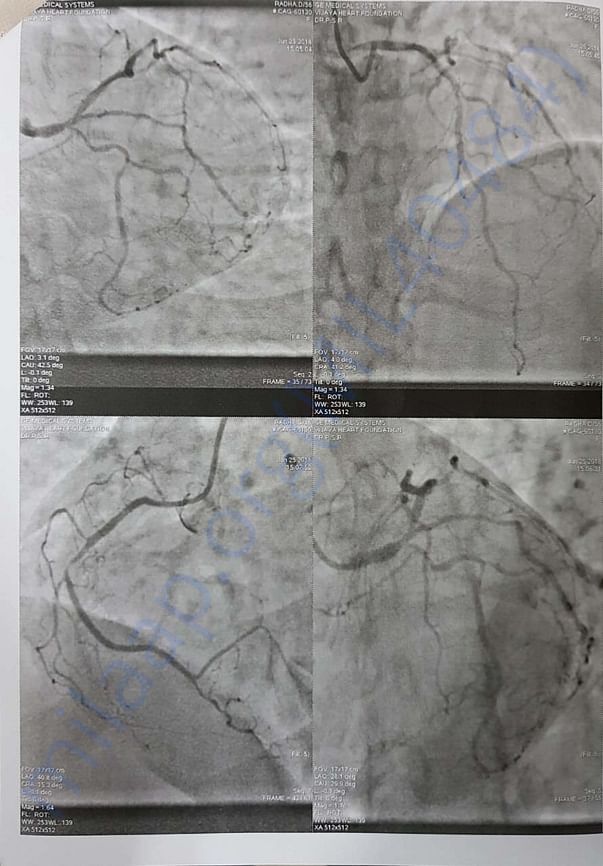 HEART BLOCK REPORT SHEET