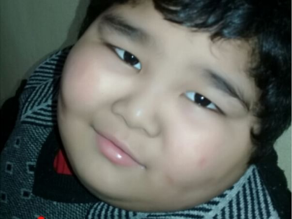 Help My Son With Down Syndrome