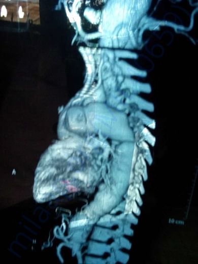 SCANNING DOC