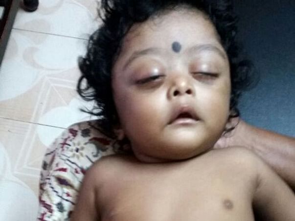 Help Baby Lakshit Fight Cancer.