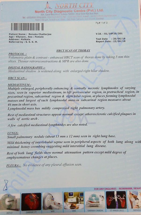 CT Scan 1