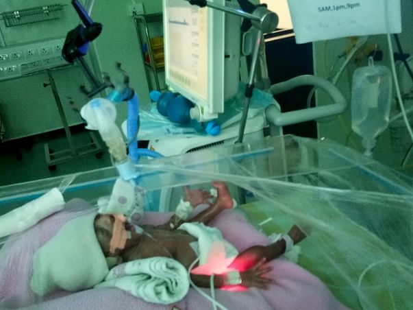 Help Me To Save My Premature Female Baby