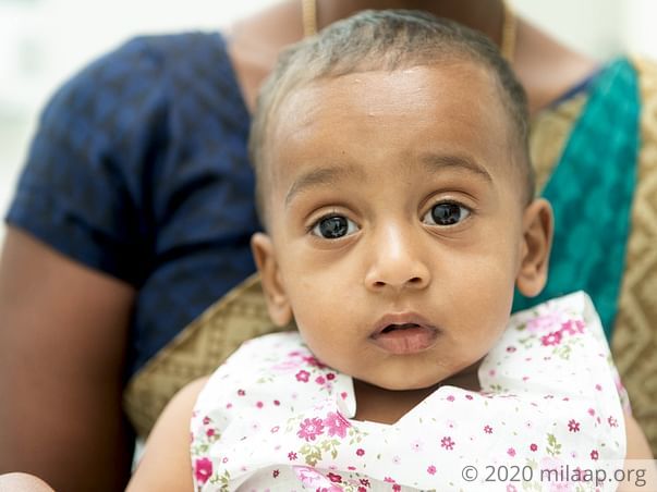 A Deadly Bone Infection Will Cripple And Kill This 1-year-old Baby