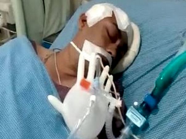 Help Hanumanth from Brain Hemorrhage.