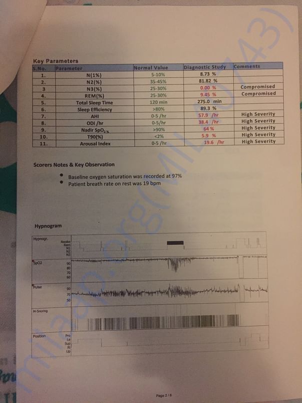 Report 2