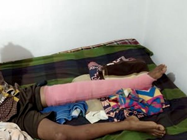 Help My Watchman's Young Child Raise Funds For His Broken Leg