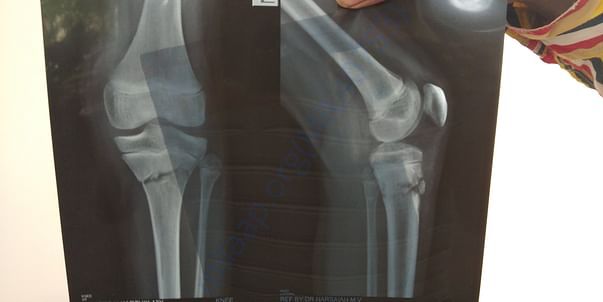 Xray