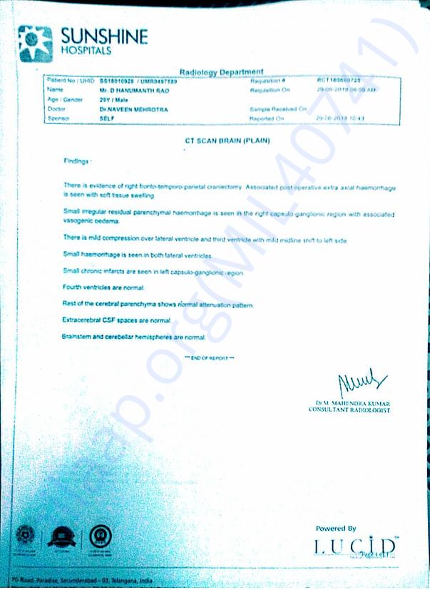 CT scan report
