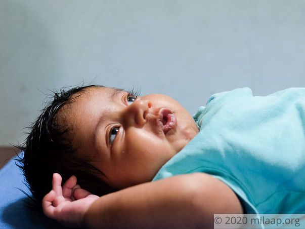2-Month-Old Struggles To Live Due To A Failing Heart