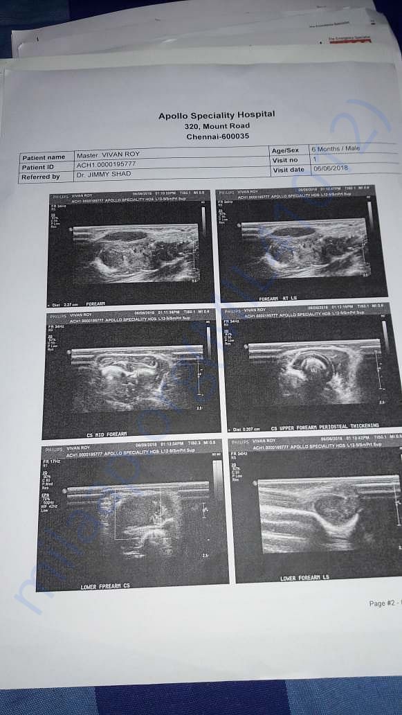 Vivan scan