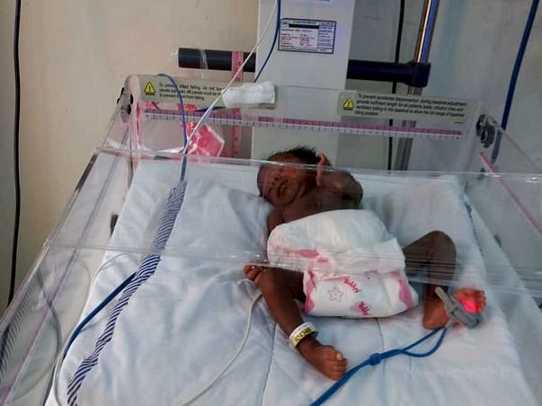 Help For Premature Twins of Sayantani.