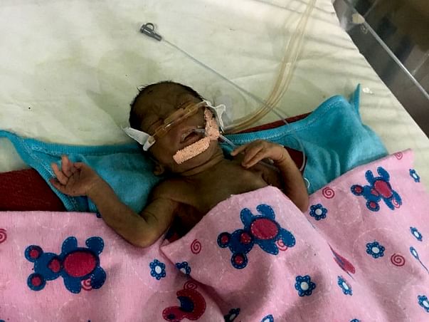 Help New Born Premature Baby to Survive