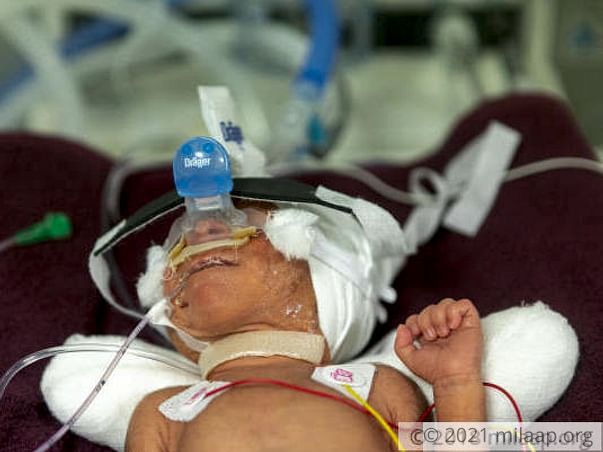 Help Srinivas and Eshwaramma save their new born baby boy