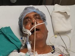 Please Help my Father fighting Septocemia