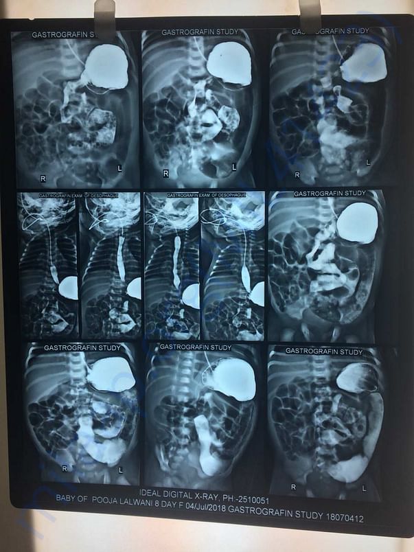 Xray film 1