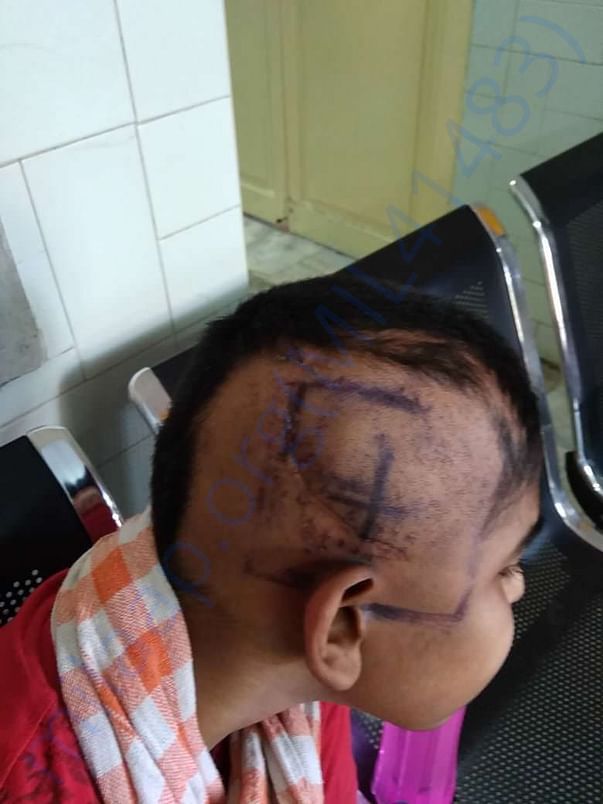 Ashwin after the operation