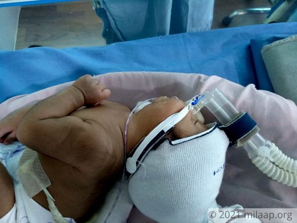 Help this 2-month-old who cannot breathe or eat