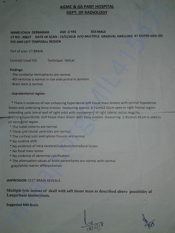 CT SCAN REPORT