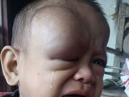 Help Aichuk Fight Against Tumour