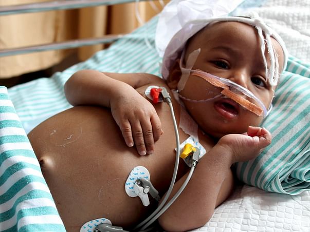 Large Tumor Has Damaged This 9-Month-Old’s Liver Completely
