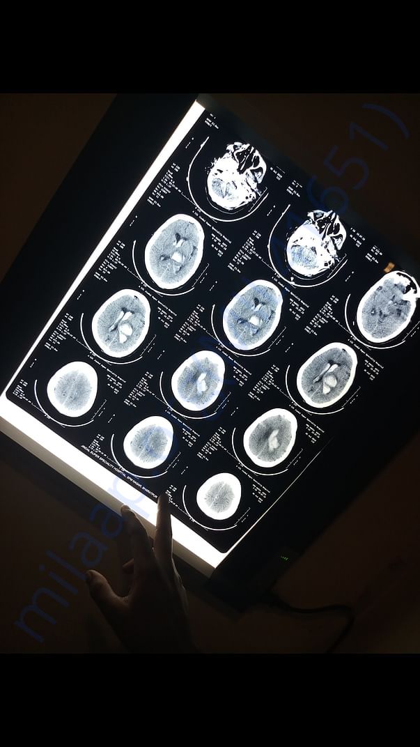 Head scan