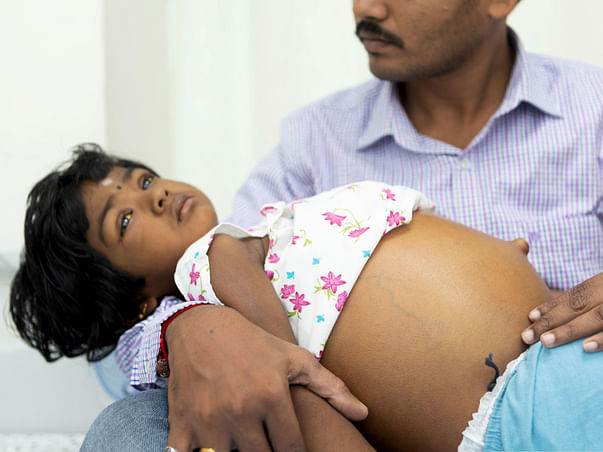 3-year-old's Stomach Is Swollen To The Size Of A Football