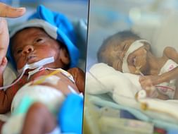Professor Is Desperately Trying To Save Her 2-Month-Old Twin Girls