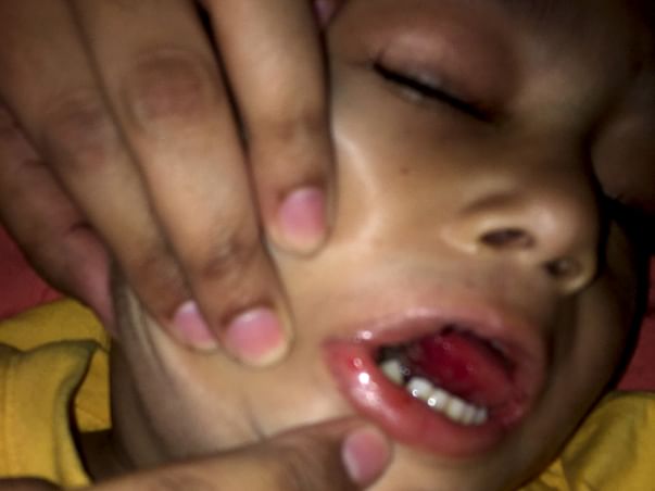 Help Baby Abdul Barr