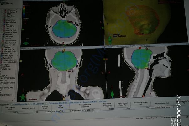 Brain MRI Scan