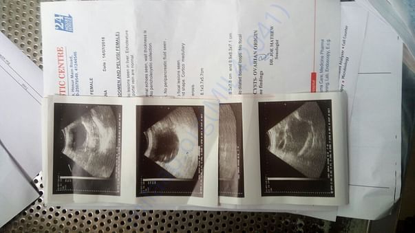 Scan