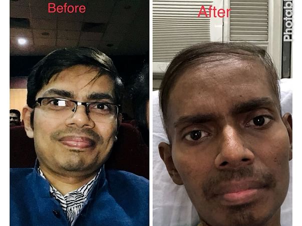 Help Dr. Soumen Fight Blood Cancer.