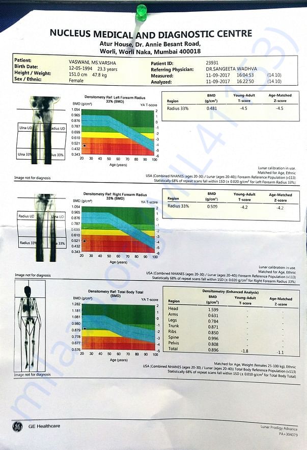 Dexa scan