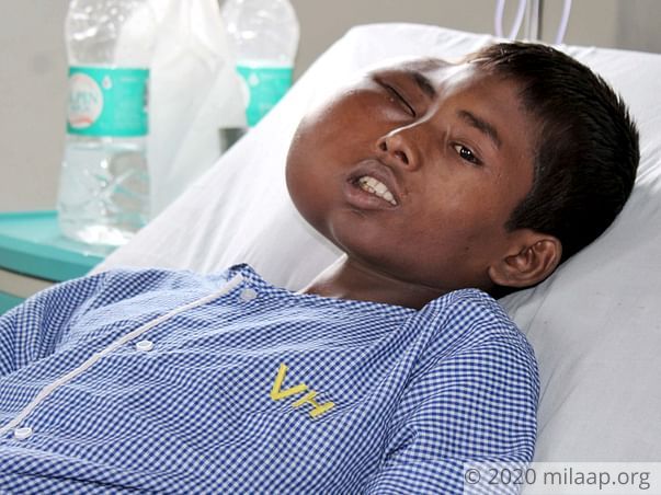15-Year-Old With Rare Facial Tumor Will Die Without Treatment