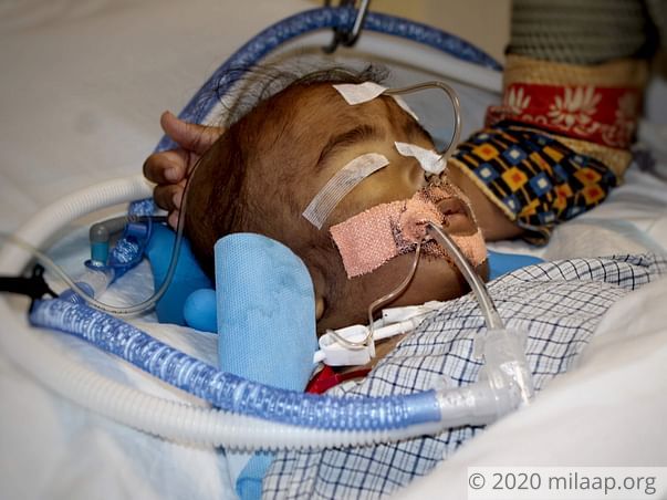 Help 1-Year-Old Arush beat Pneumonia and come out of the ICU alive