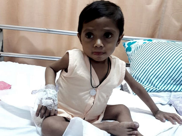 Liver Transplantation For My 2yrs Old Baby Boy
