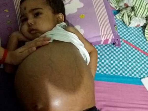 Help Save Little Prabal.