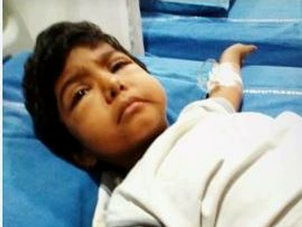 Please Save My Child Vishishta Fighting Chronic Nephrotic Syndrome