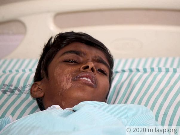 Help this 13-year-old who is critical after an accidental fall