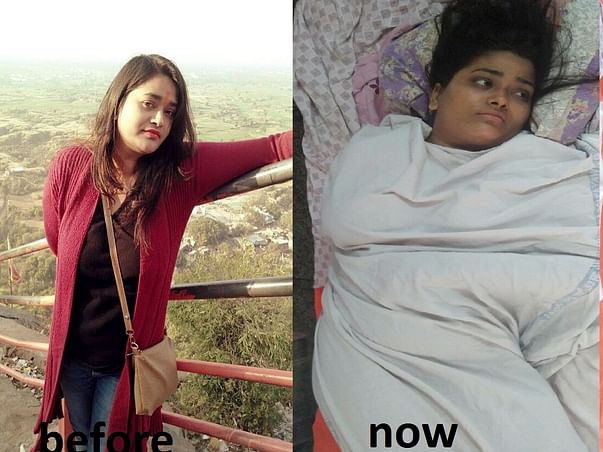 Help Yogita Suffering From Breast And Bone Cancer.