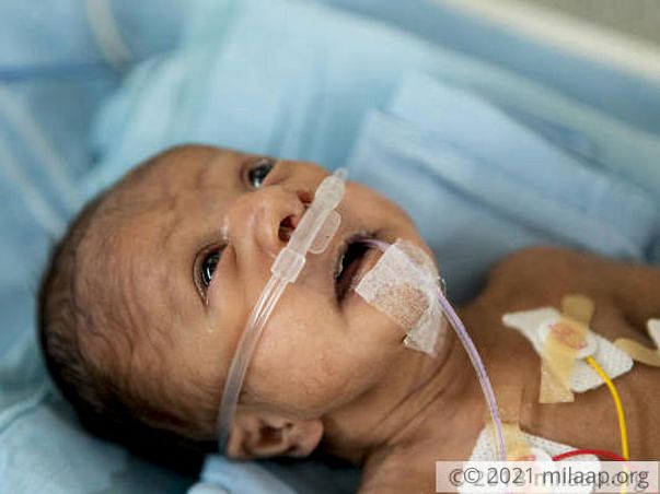 Premature Baby Born With A Hole In The Heart Needs Treatment