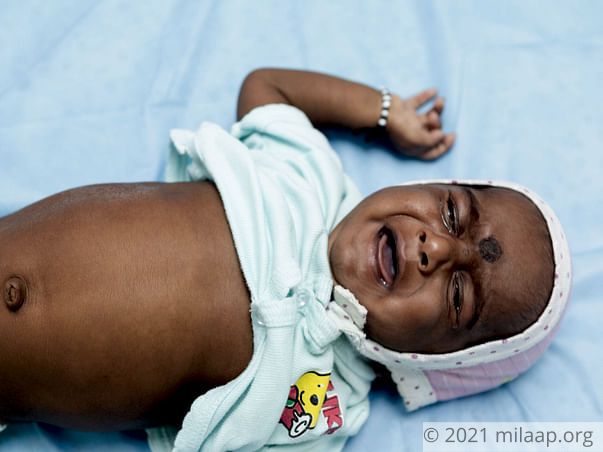 4-month-old Naga Lokesh needs a liver transplant