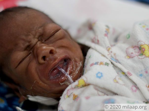 This 2-month-old baby boy will not survive without urgent help