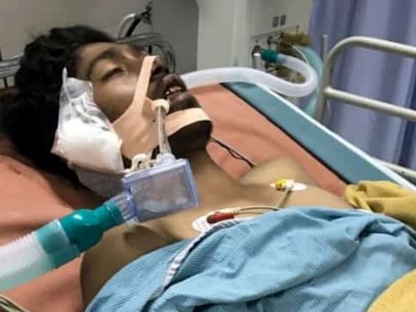 Help K.Bala kumar recover fast. Met with an accident,very critical.